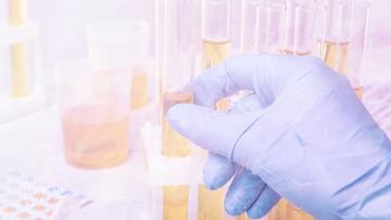 Urine